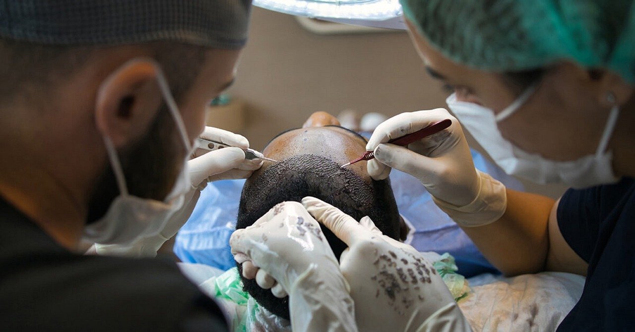 hair transplant, treatment, surgery-7518352.jpg